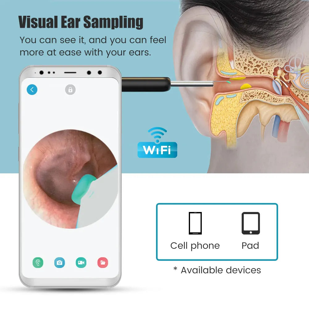 Wireless Smart Ear Cleaning Endoscope